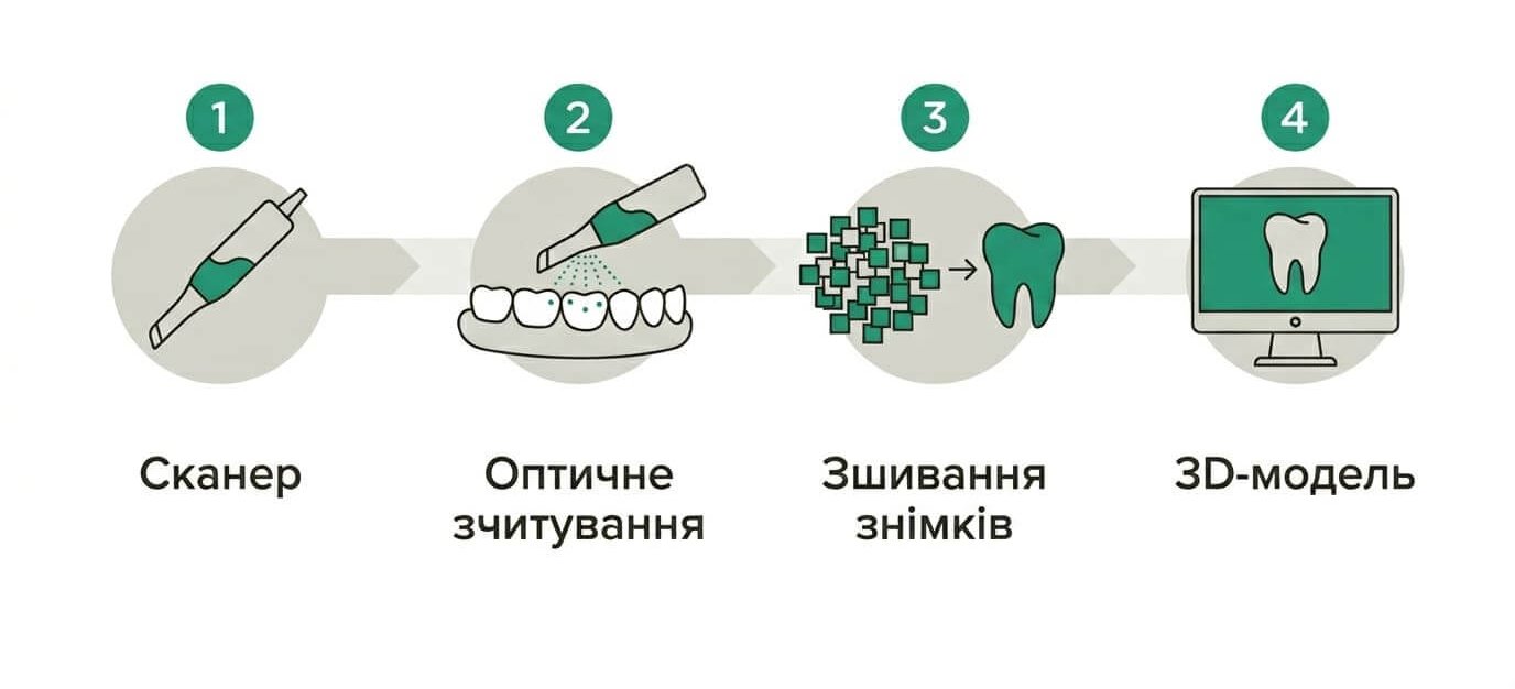 Сканування зубів 3д