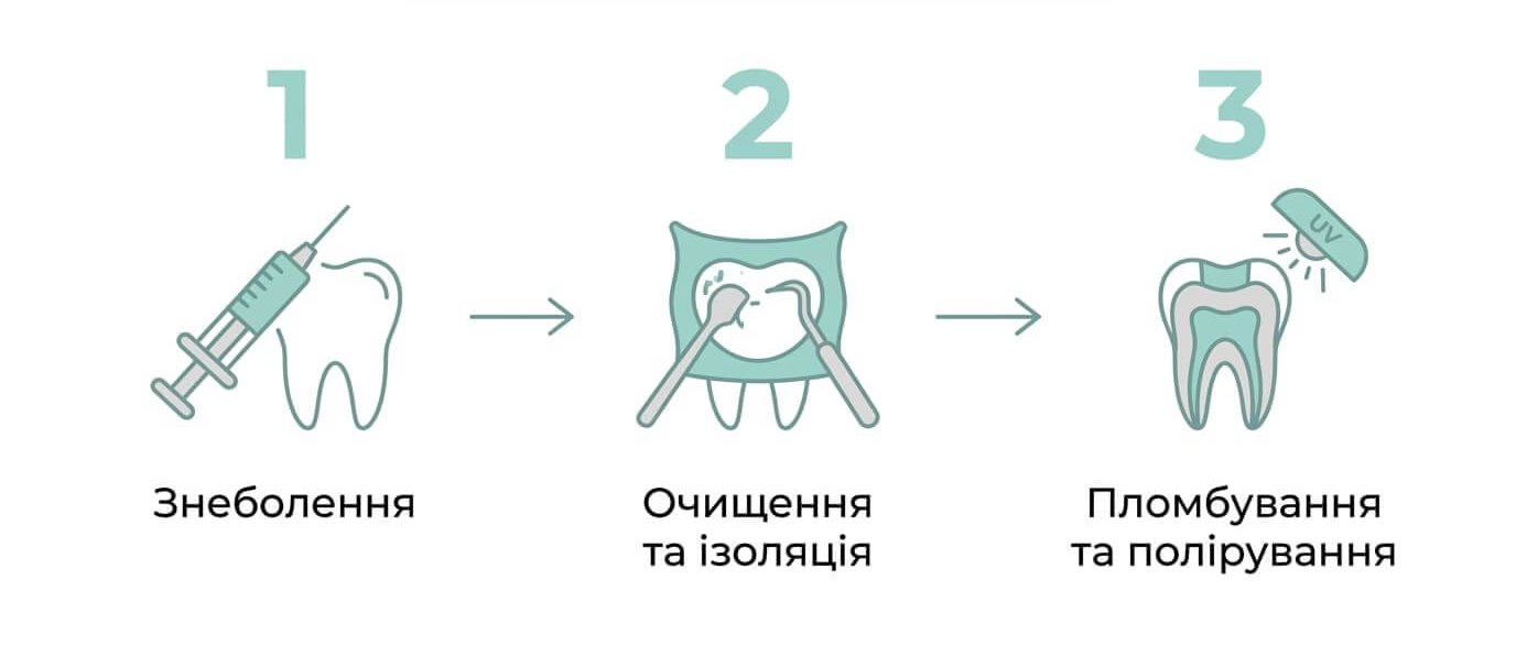 Встановлення пломби